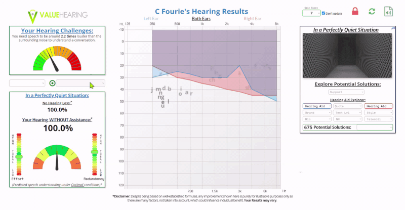 Cognimatch - Clearly Understand your hearing test results and options