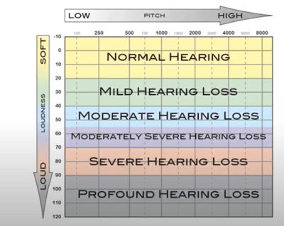 Hearing Loss Degree