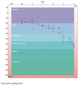 Hearing test result