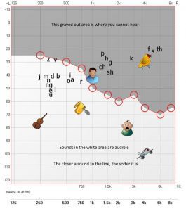 Audiogram showing difficulty hearing speech in noise