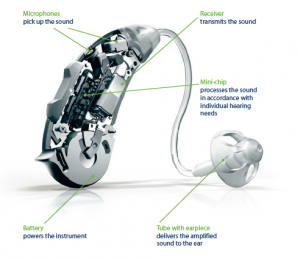 The various parts in a hearing aid
