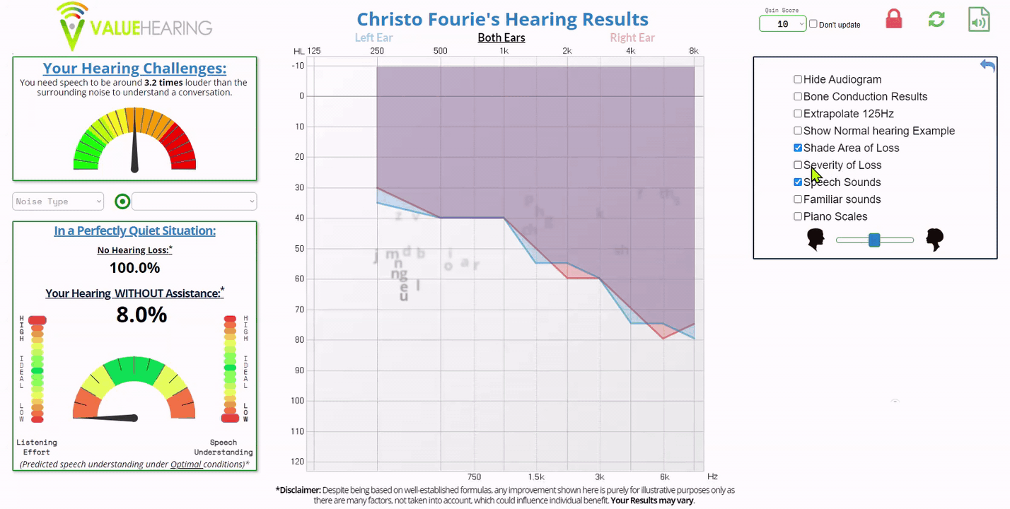 An audiogram that is obtained as part of our hearing test