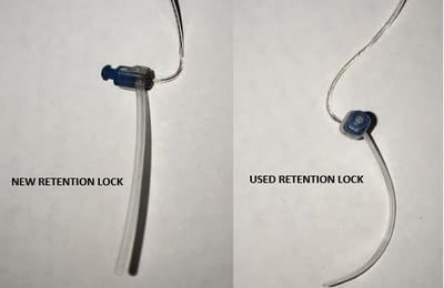 retention lock image 2